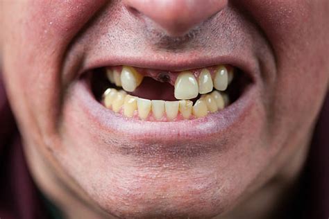 Royalty Free Ugly Teeth Pictures, Images and Stock Photos - iStock