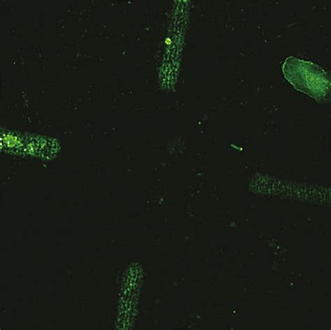 Fluorescence microscope image of a processed region. | Download ...