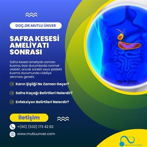 Safra Kesesi Ameliyat Sonras Safra Ka A Belirtileri