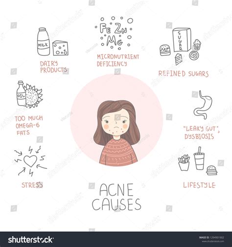 Acne Causes Skin Problems Deseases Factors Stock Vector Royalty Free