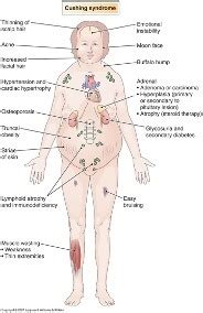 Endocrine Pathology Phase 1 Flashcards Quizlet