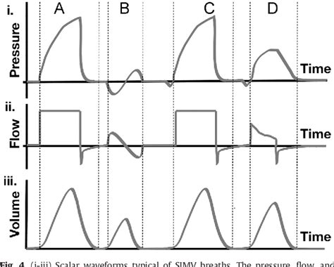 Figure 4 from Ventilator waveforms. | Semantic Scholar