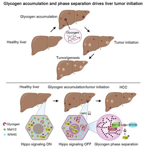 glycogen accumulation  phase separation drives liver tumor