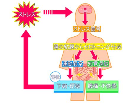 過敏性腸症候群についての報告 けんこうカイロプラクティックセンター