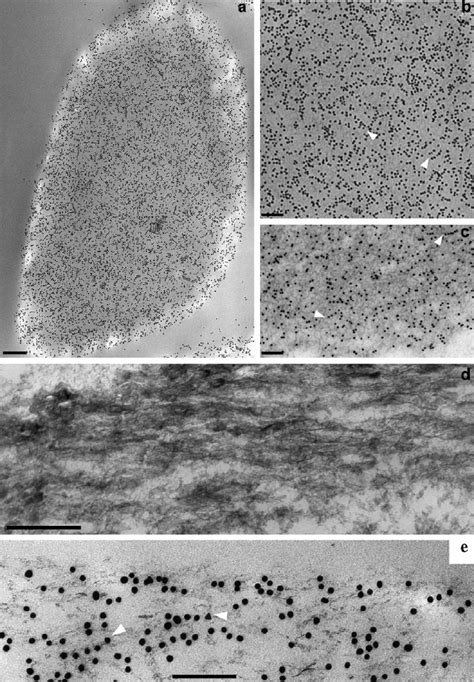 Immunogold TEM Of OC90 In Outer Cortex A Low Magni Fi Cation View Of