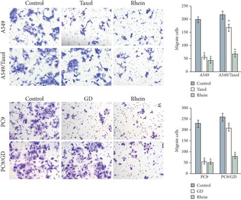 Rhein Suppresses The Metastasis Of Chemosensitive And Chemoresistant