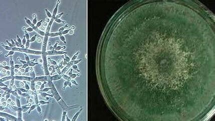 Trichoderma Harzianum Biofertilizante Nutrifitos Tecnologia Hort Cola