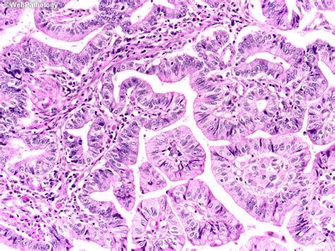 A Collection Of Surgical Pathology Images