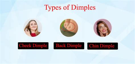 Types Dimples