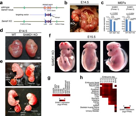 SAMD1 KO Mice Are Embryonic Lethal Lack Blood Vessels And Exhibit