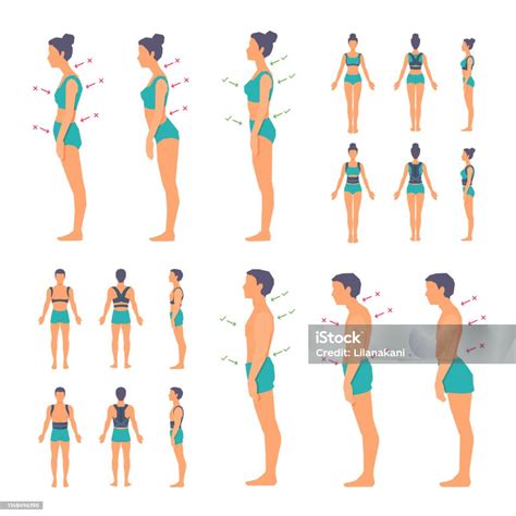 Ilustración De Postura Correcta E Incorrecta De La Columna Vertebral