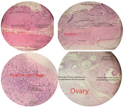 Figure 1 From Use Of Labeled Histology Images With Key Identification