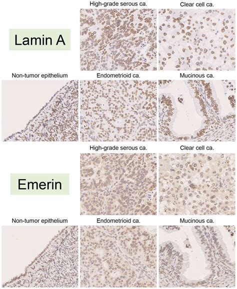 Role Of Lamin A And Emerin In Maintaining Nuclear Morphology In