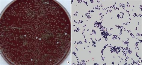 A Image Of Rothia Mucilaginosa Grown On A Blood Agar Plate Showing