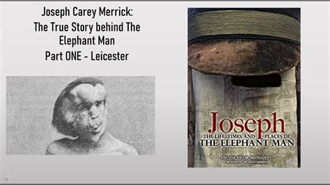 Joseph Carey Merrickthe True Story Behind The Elephant Man Part One