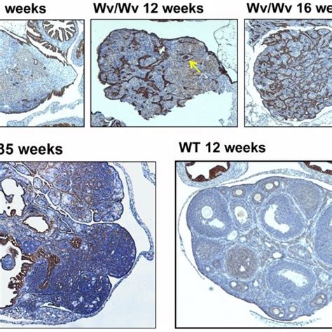 Working Model For Follicle Depletion And Ovarian Aging In Ovarian