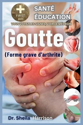 Goutte Forme Grave D Arthrite Causes Sympt Mes Gestion Des