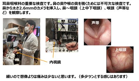 内視鏡検査について 池袋ながとも耳鼻咽喉科