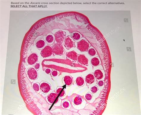 Solved Based On The Ascaris Cross Section Depicted Below Chegg