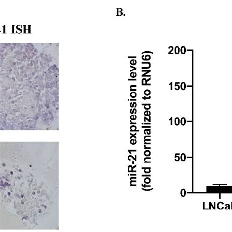 Mir 21 Downregulation Reduced The Wound Healing Capacity Of Lncap Cells