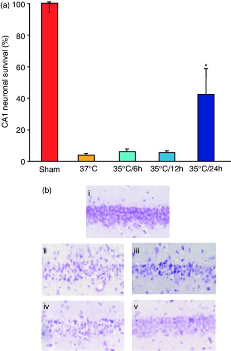 Effects Of Different Durations Of Mild Hypothermia On Ca Neuronal