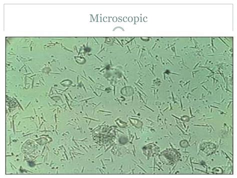 Diagnostic approach to knee joint effusion | PPTX