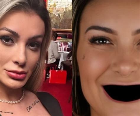 Notícias Andressa Urach aparece sem os dentes e espanta fãs Achei