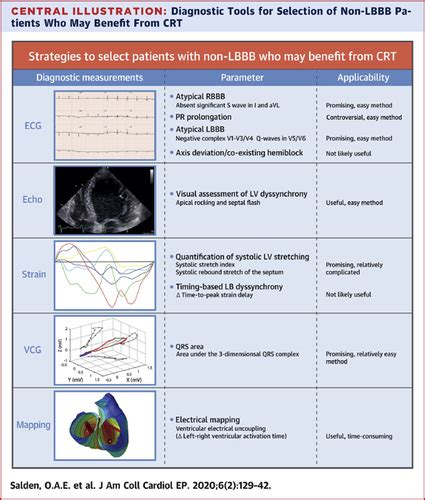 Cardiac Resynchronization Therapy Ecg