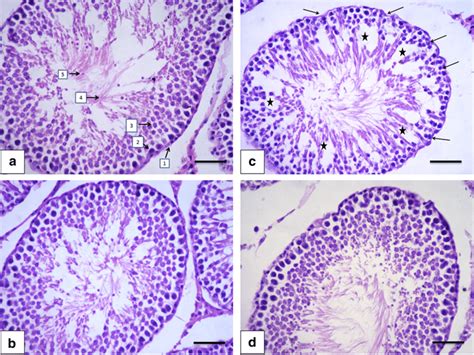 Higher Magnification Of Photomicrograph Of Testis Sections From All