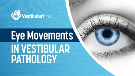 Eye Movements In Vestibular Pathology YouTube