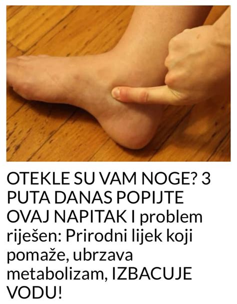 Otekle Su Vam Noge Popijte Ovaj Napitak Puta Dnevno I Problem Je