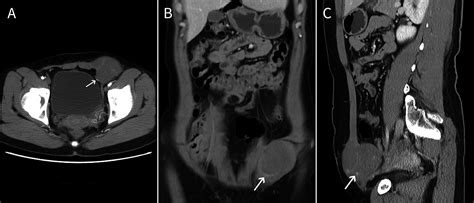 Dual Phase Contrast Enhanced Multislice Computed Tomography Scans Play