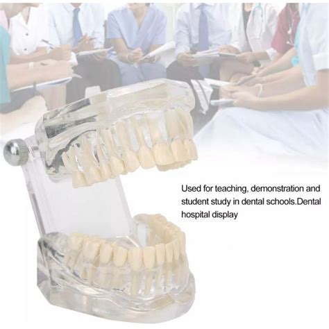 Jual Dental Model Gigi Transparan Phantom Gigi Praktikum Bening