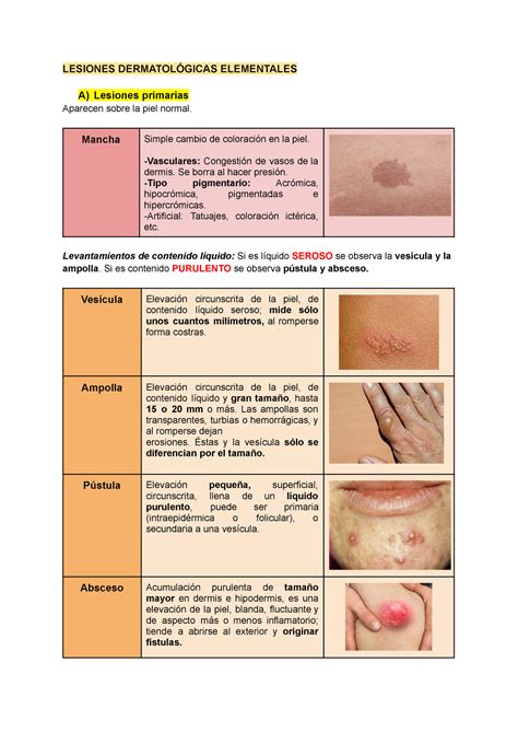 Lesiones Elementales Derma Lesiones Dermatol Gicas Elementales A