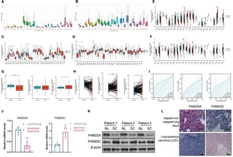 Frontiers FAM20A A Potential Diagnostic Biomarker For Lung Squamous