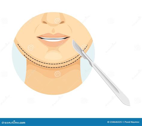 Chin Correction Procedure Cosmetic Surgery On Female Face With Dotted