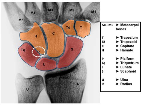 Anatomie Z P St Anatomick Struktury A Funkce Ortopedick