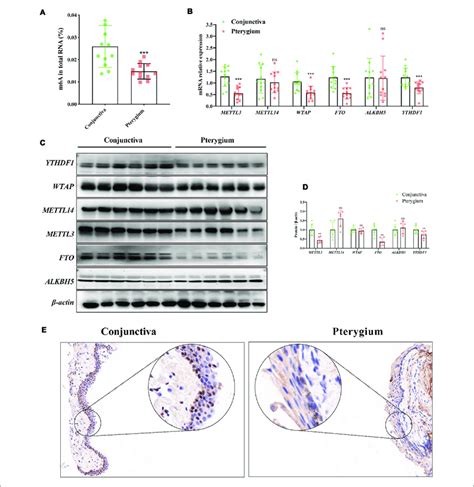 M6a And Mettl3 Are Downregulated In Pterygium A Quantification Of Download Scientific