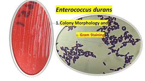 Enterococcus Durans Colony Morphology Wet Mount And Gram Staining