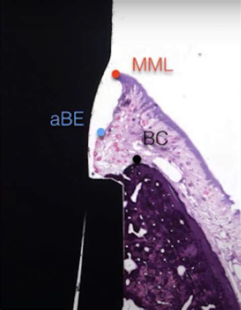 Soft Tissue Implant Integration Part 3