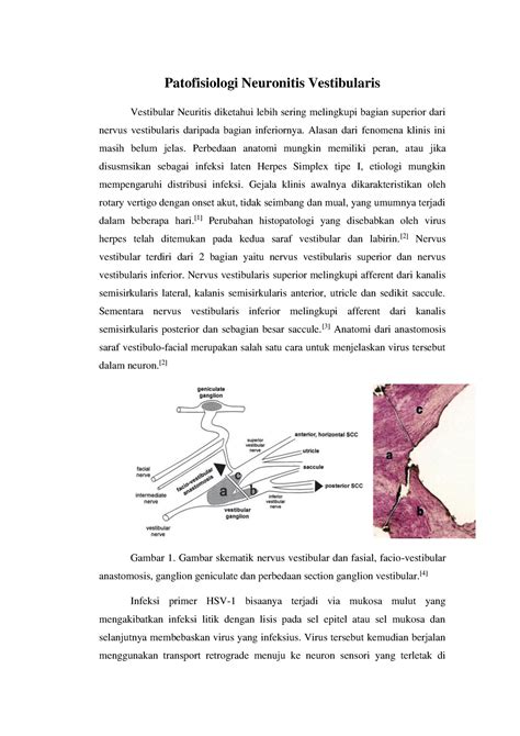 Patofisiologi Neuronitis Vestibularis Patofisiologi Neuronitis