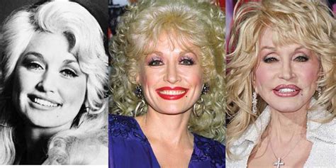 Dolly Parton Plastic Surgery Before and After Pictures 2018