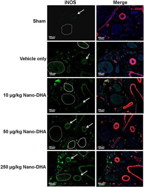 The Distribution Of Inducible Nos Inos In The Dorsal Penile Nerve And