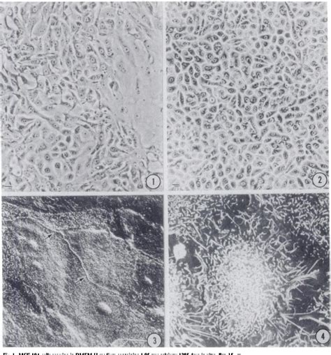 Figure From Ultrastructural And Immunocytochemical Characterization