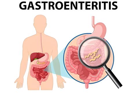 Understanding Key Signs Of Gastroenteritis