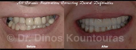 Treatment of facial and dental deformities - Dr. Dinos Kountouras