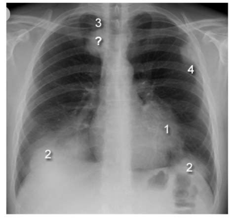 Imaging Midterm Lecture Material Flashcards Quizlet