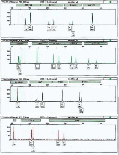 str profile  dna   decorative hair band recovered   crime