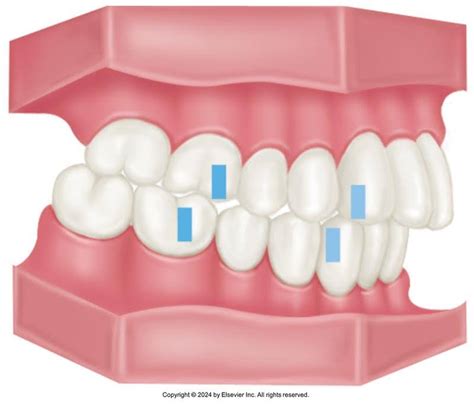 Overview Of Dentitions Part A Oral Facial Anatomy Online