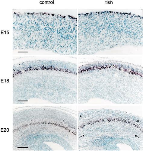 Calretinin Positive Neurons In The Developing Cortex Anti Calretinin